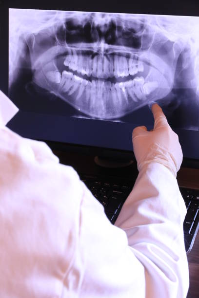 Best Emergency Treatment for Dental Infections or Abscesses in First Mesa, AZ