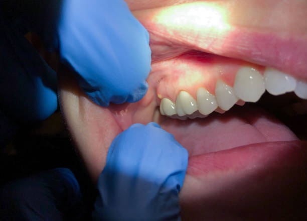 Best Emergency TMJ Treatment in First Mesa, AZ