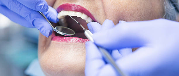 Best Emergency Tooth Extraction in First Mesa, AZ